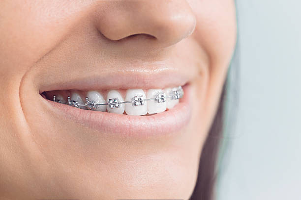 Trusted Iona, FL Dental Services Experts